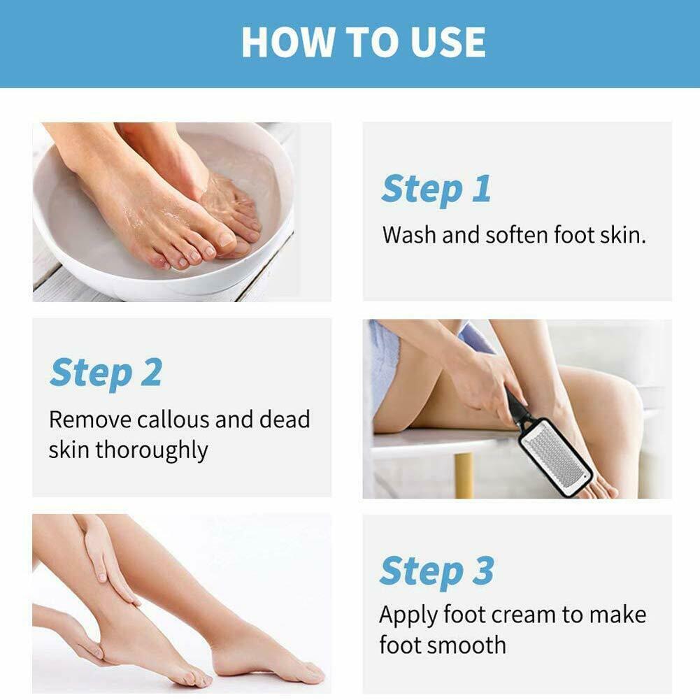 Foot Callus Remover File Rasp Scraper