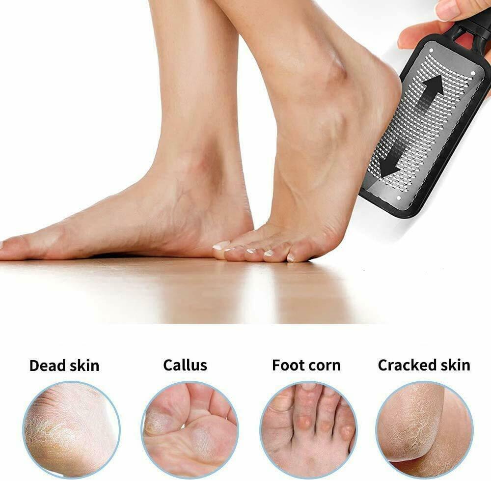 Foot Callus Remover File Rasp Scraper