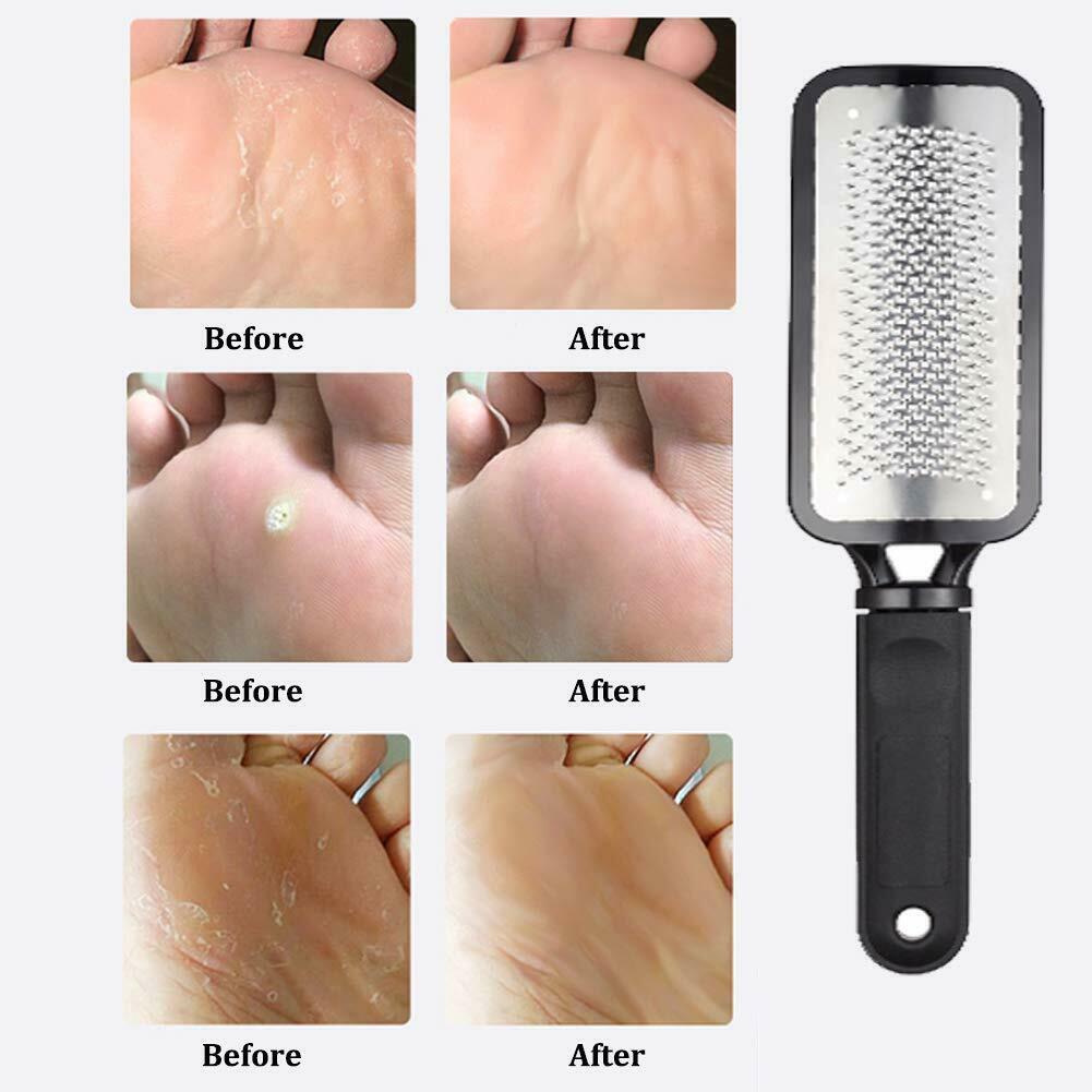 Foot Callus Remover File Rasp Scraper